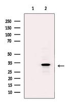 COLEC11 Polyclonal Antibody