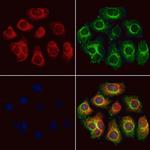 COQ9 Polyclonal Antibody