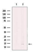 DNAJC19 Antibody in Western Blot (WB)