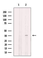 eIF2b alpha Antibody in Western Blot (WB)