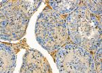 GREM2 Polyclonal Antibody