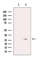 GSTM3 Polyclonal Antibody