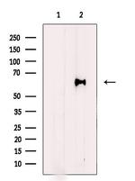HPSE Polyclonal Antibody