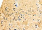 MAP1B Polyclonal Antibody