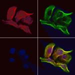 OPA3 Polyclonal Antibody