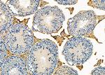 PARVB Antibody in Immunohistochemistry (Paraffin) (IHC (P))