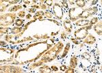 PDHB Polyclonal Antibody