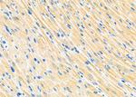 PIP5K1A Polyclonal Antibody