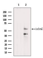 PIP5K1A Antibody in Western Blot (WB)