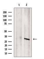 SAT1 Polyclonal Antibody