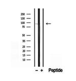 EXOC3 Antibody in Western Blot (WB)