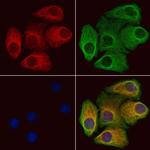 SRPX2 Polyclonal Antibody