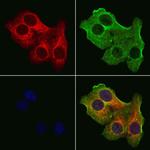 TIMM9 Antibody in Immunocytochemistry (ICC/IF)