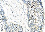 TIMM9 Antibody in Immunohistochemistry (Paraffin) (IHC (P))