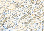 TIMM9 Antibody in Immunohistochemistry (Paraffin) (IHC (P))