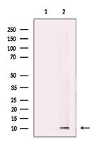 TIMM9 Antibody in Western Blot (WB)