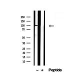 TRPC4AP Antibody in Western Blot (WB)