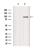 TRPC4AP Antibody in Western Blot (WB)