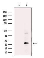 UBE2E2 Polyclonal Antibody