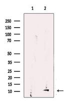 UQCRQ Antibody in Western Blot (WB)