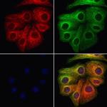 VPS11 Polyclonal Antibody