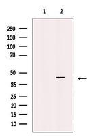 WISP1 Polyclonal Antibody