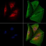 NFYC Antibody in Immunocytochemistry (ICC/IF)
