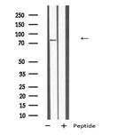 TBC1D10B Antibody in Western Blot (WB)