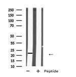 HIV1 (Virion infectivity factor) Polyclonal Antibody
