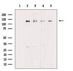JMY Polyclonal Antibody