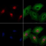 c-MAF Polyclonal Antibody