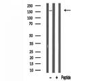 DGKI Antibody in Western Blot (WB)