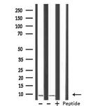 HMGN2 Polyclonal Antibody