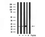 Histone 1F0 Polyclonal Antibody