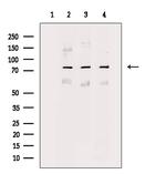 SnoN Antibody in Western Blot (WB)