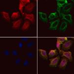 SnoN Polyclonal Antibody