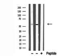 SnoN Antibody in Western Blot (WB)