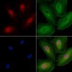 ZNF18 Polyclonal Antibody