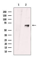 ZNF18 Antibody in Western Blot (WB)