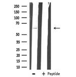 ZNF18 Antibody in Western Blot (WB)