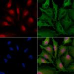 ZNF24 Antibody in Immunocytochemistry (ICC/IF)
