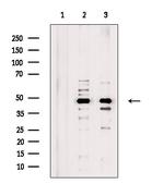 ZNF24 Antibody in Western Blot (WB)