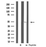 ZNF24 Antibody in Western Blot (WB)