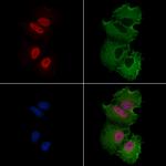 ATF7 Polyclonal Antibody