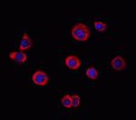 DGKA Polyclonal Antibody