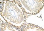 DGKA Antibody in Immunohistochemistry (Paraffin) (IHC (P))