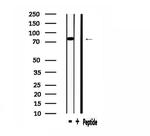 DGKA Antibody in Western Blot (WB)