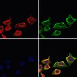 LTK Polyclonal Antibody