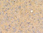 LTK Antibody in Immunohistochemistry (Paraffin) (IHC (P))