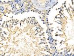 LTK Antibody in Immunohistochemistry (Paraffin) (IHC (P))